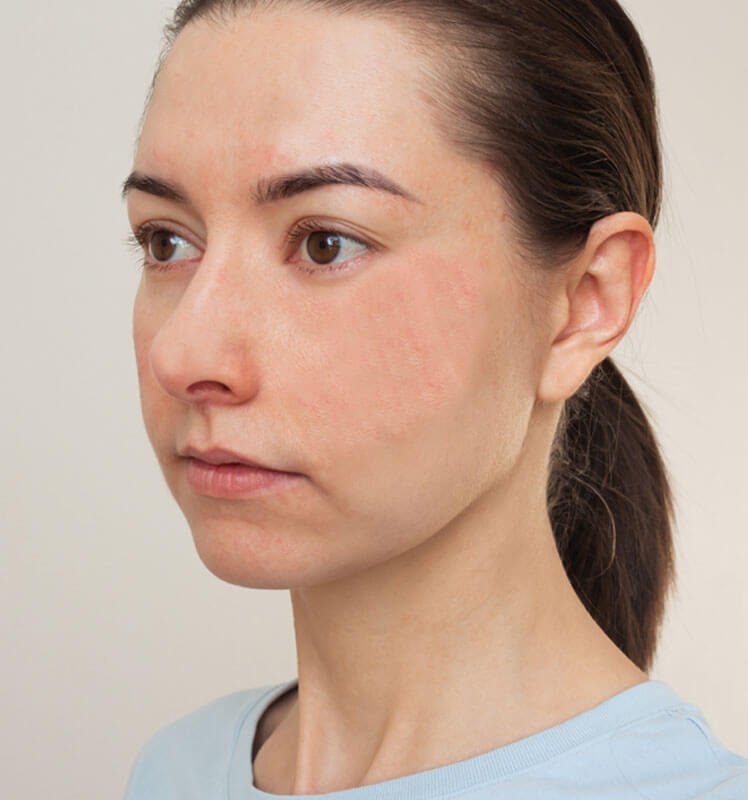 home-one-1-after-image