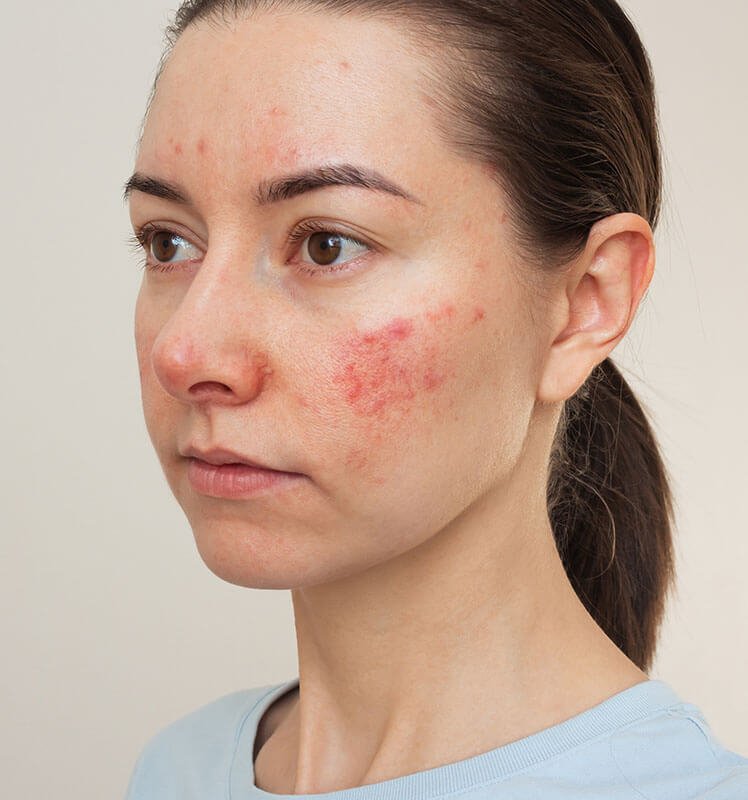 home-one-1-before-image