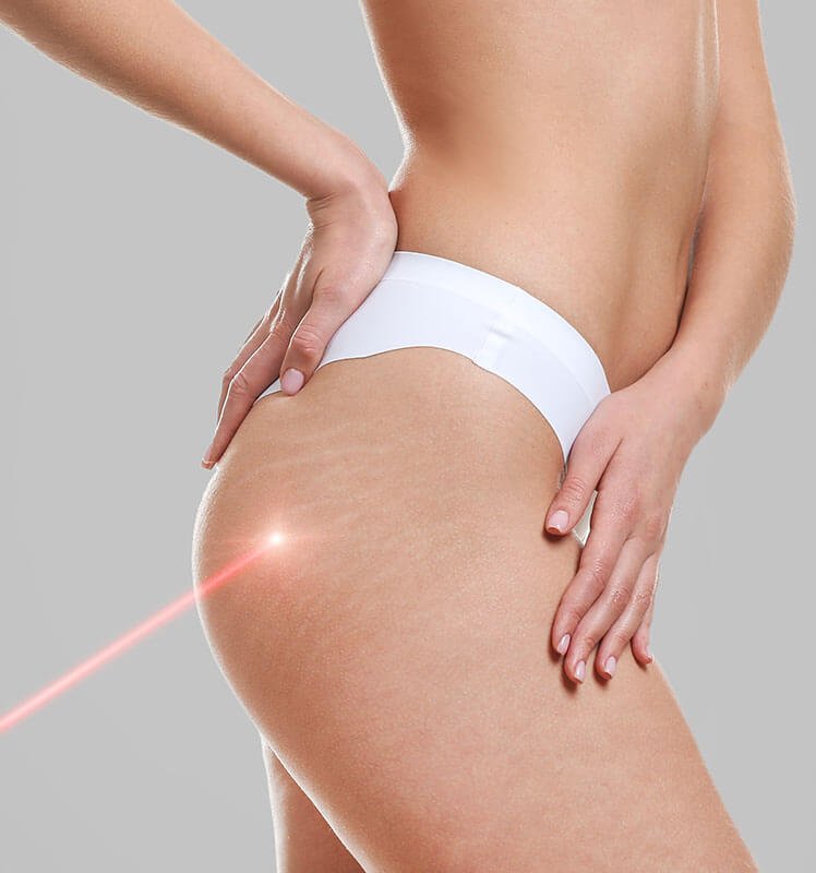 home-one-2-before-image