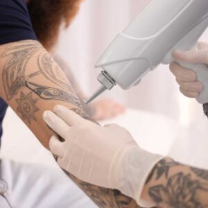 Tattoo Removal & Brows Removal